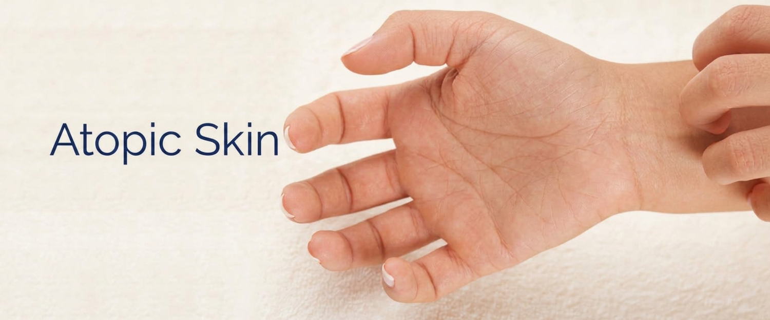 Atopic Skin