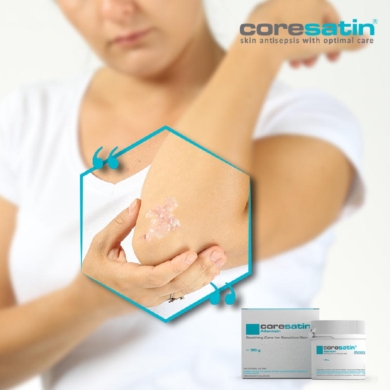 Allantoin Soothing Care for Sensitive Skin