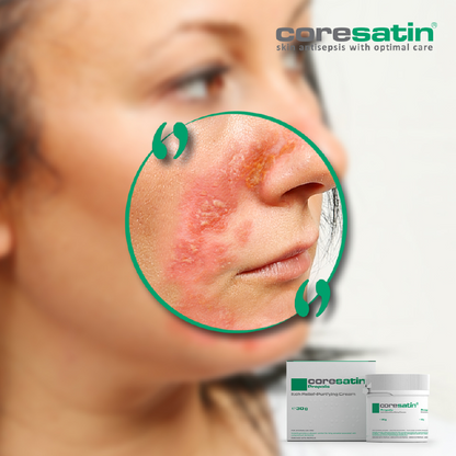 Propolis Itch Relief Purifying Cream