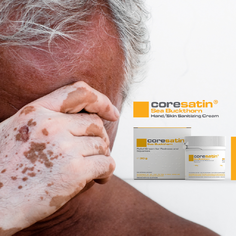 Sea Buckthorn Relief Cream for Redness and Squames