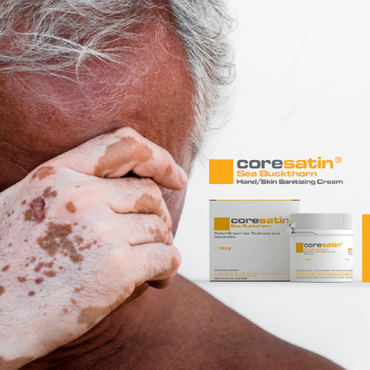 Sea Buckthorn Relief Cream for Redness and Squames